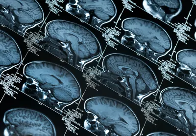Tiled blue-gray MRI readouts of a human brain.